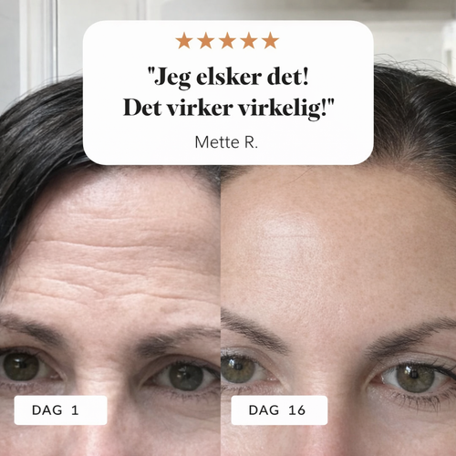 Magic Wrinkle & Eraser Night Balm